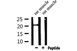 Western blot analysis of extracts from rat muscle, using CRH Antibody. (CRH antibody  (N-Term))