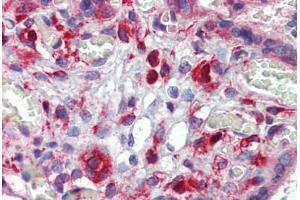 Human Placenta: Formalin-Fixed, Paraffin-Embedded (FFPE) (AAK1 antibody  (N-Term))