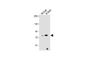 All lanes : Anti-ZBT24 Antibody (N-term) at 1:1000 dilution Lane 1: Mouse liver lysate Lane 2: Rat liver lysate Lysates/proteins at 20 μg per lane. (ZBTB24 antibody  (N-Term))
