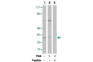 Western blot analysis of extracts from LoVo cells (Lane 1) and Jurkat cells (Lane 2 and 3) treated with PMA (125 ng/mL, 30 min), using MARCKS polyclonal antibody . (MARCKS antibody  (Ser162.))