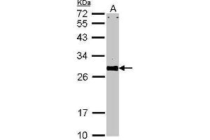 WB Image Sample (30 ug of whole cell lysate) A: NIH-3T3 12% SDS PAGE VAPA antibody antibody diluted at 1:1000
