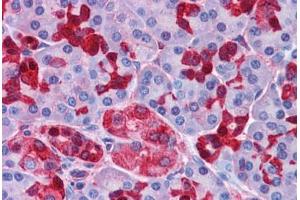 Human Pancreas: Formalin-Fixed, Paraffin-Embedded (FFPE) (OTUD4 antibody  (C-Term))
