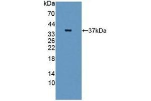 Detection of Recombinant GBP4, Human using Polyclonal Antibody to Guanylate Binding Protein 4 (GBP4) (GBP4 antibody  (AA 1-292))