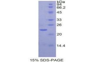 SDS-PAGE (SDS) image for Heparan Sulphate Protoglycans (HSPG) (AA 19-144) protein (His tag) (ABIN1099144)