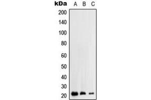 Western blot analysis of RhoH expression in HEK293T (A), HepG2 (B), Jurkat (C) whole cell lysates. (RHOH antibody  (C-Term))