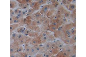 Used in DAB staining on fromalin fixed paraffin- embedded liver tissue (TRO antibody  (AA 444-642))