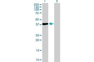 Western Blot analysis of NKX2-5 expression in transfected 293T cell line by NKX2-5 MaxPab polyclonal antibody. (NK2 Homeobox 5 antibody  (AA 1-324))
