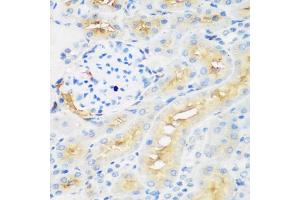 Immunohistochemistry of paraffin-embedded rat kidney using PROCR antibody (ABIN6291490) at dilution of 1:200 (40x lens).