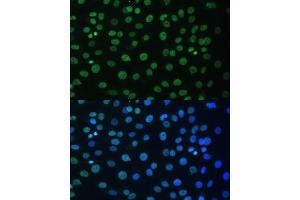 Immunofluorescence analysis of C6 cells using HNRNPD antibody (ABIN7267632) at dilution of 1:100. (HNRNPD/AUF1 antibody  (AA 1-306))