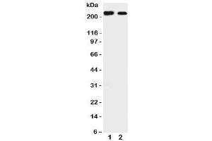 Western blot testing of Tuberin antibody and Lane 1:  rat liver (Tuberin antibody  (C-Term))