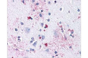 Immunohistochemical staining of Brain Cortex using AP31144PU-N SLC29A1 antibody (SLC29A1 antibody  (Internal Region))