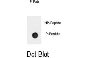 Image no. 1 for anti-Adrenergic, beta-2-, Receptor, Surface (ADRB2) (pSer261) antibody (ABIN358476) (beta 2 Adrenergic Receptor antibody  (pSer261))
