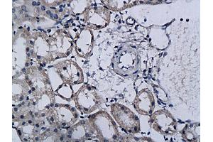 Formalin-fixed and paraffin embedded rat kidney labeled with Anti-TPA/PLAT Polyclonal Antibody, Unconjugated (ABIN731123) followed by conjugation to the secondary antibody and DAB staining (PLAT antibody  (AA 485-562))