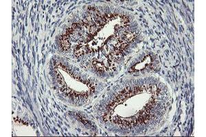 Image no. 4 for anti-Golgi Membrane Protein 1 (GOLM1) antibody (ABIN1498497) (GOLM1 antibody)