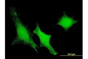 Immunofluorescence of monoclonal antibody to DUSP3 on HeLa cell.