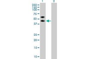 Western Blot analysis of SERPINA3 expression in transfected 293T cell line by SERPINA3 MaxPab polyclonal antibody. (SERPINA3 antibody  (AA 1-423))