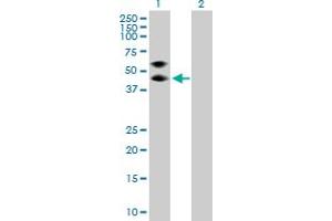 Western Blot analysis of SERPINA3 expression in transfected 293T cell line by SERPINA3 MaxPab polyclonal antibody.