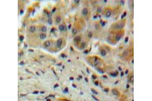 Used in DAB staining on fromalin fixed paraffin-embedded Liver tissue (SERPINA10 antibody  (AA 6-125))