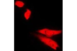 Immunofluorescent analysis of Topoisomerase 2 beta staining in Jurkat cells. (TOP2B antibody  (N-Term))