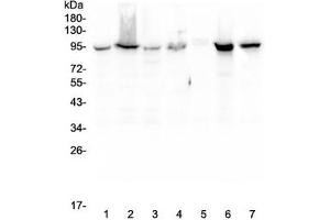 Western blot testing of human 1) HeLa, 2) COLO-320, 3) HepG2, 4) MCF7, 5) SW620, 6) 22RV1 and 7) Jurkat lysate with Beta Catenin antibody. (beta Catenin antibody  (AA 2-233))