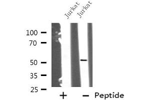 Western blot analysis of KRT12 using Jurkat whole cell lysates