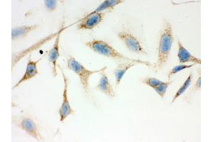 Immunohistochemistry (IHC) image for anti-Hydroxysteroid (17-Beta) Dehydrogenase 10 (HSD17B10) (AA 48-261) antibody (ABIN3042460)