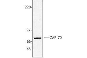 Image no. 1 for anti-zeta-Chain (TCR) Associated Protein Kinase 70kDa (ZAP70) (AA 282-307) antibody (ABIN205364) (ZAP70 antibody  (AA 282-307))