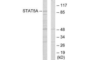 Western Blotting (WB) image for anti-Signal Transducer and Activator of Transcription 5A (STAT5A) (Internal Region) antibody (ABIN1849361) (STAT5A antibody  (Internal Region))