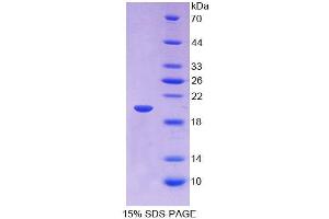 SDS-PAGE analysis of Human IGFBP2 Protein.