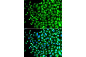 Immunofluorescence analysis of A549 cells using SUPT20H antibody. (FAM48A/P38IP antibody)