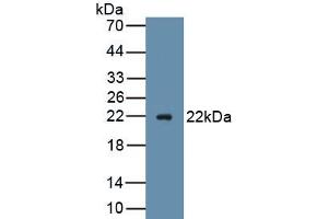 Detection of Recombinant AVIL, Mouse using Polyclonal Antibody to Advillin (AVIL) (Advillin antibody  (AA 1-160))