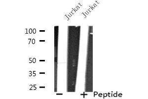 Western blot analysis of extracts from Jurkat cells, using TEAD3 antibody. (TEAD3 antibody  (Internal Region))