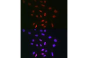 Immunofluorescence analysis of U-2 OS cells using TDP1 Rabbit pAb (ABIN1682992, ABIN3019238, ABIN3019239 and ABIN6220782) at dilution of 1:100 (40x lens). (TDP1 antibody  (AA 1-140))