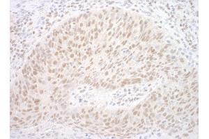 anti-Chromobox Homolog 7 (CBX7) (AA 201-251) antibody