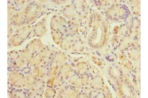 Immunohistochemistry of paraffin-embedded human pancreatic tissue using ABIN7171606 at dilution of 1:100 (TBC1D19 antibody  (AA 1-300))