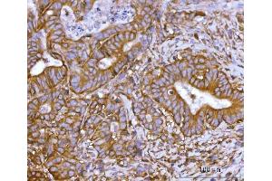 IHC analysis of SNAP23 using anti-SNAP23 antibody (ABIN7599089). (SNAP23 antibody  (AA 1-211))