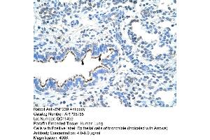 Human Lung (ZNF239 antibody  (Middle Region))