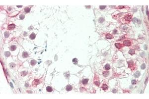 Formalin-fixed and paraffin-embedded H. (GP6 antibody  (C-Term))