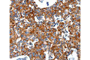 Immunohistochemistry (IHC) image for anti-Kallikrein 2 (KLK2) antibody (ABIN1873440) (Kallikrein 2 antibody)