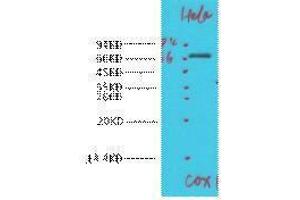 Western Blotting (WB) image for anti-Cytochrome C Oxidase Subunit I (COX1) antibody (ABIN3181265)