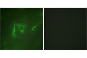 Immunofluorescence analysis of NIH-3T3 cells, using 14-3-3 zeta/delta (Ab-232) Antibody. (14-3-3 zeta antibody  (AA 196-245))