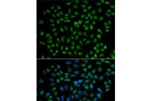 Immunofluorescence analysis of U2OS cells using RBPJ Polyclonal Antibody (RBPJ antibody)