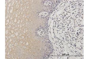 Immunoperoxidase of purified MaxPab antibody to TGM1 on formalin-fixed paraffin-embedded human uterine cervix. (TGM1 antibody  (AA 1-817))