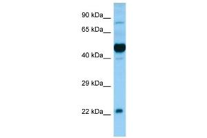 WB Suggested Anti-HCRTR1 Antibody Titration: 0. (HCRTR1 antibody  (N-Term))