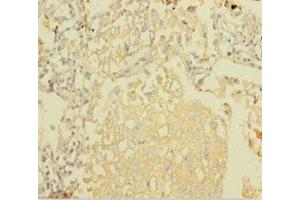 NDUFA6 antibody  (AA 27-154)
