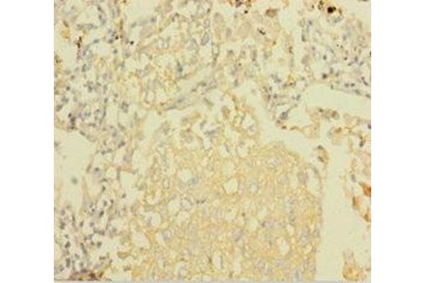 NDUFA6 antibody  (AA 27-154)