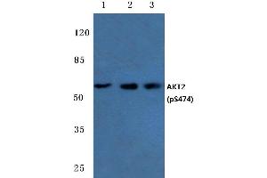 Western blot (WB) analysis of p-AKT2 antibody at 1/500 dilution (AKT2 antibody  (pSer474))