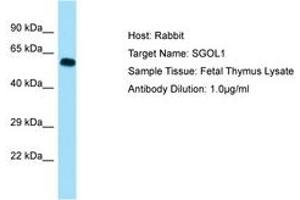 Image no. 1 for anti-Shugoshin 1 (SGOL1) (AA 395-444) antibody (ABIN6749951) (Shugoshin antibody  (AA 395-444))