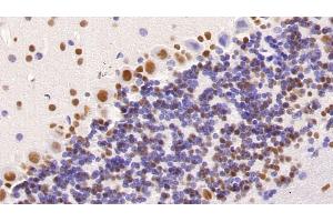 Immunohistochemistry (IHC) image for anti-Histone Deacetylase 1 (HDAC1) (AA 1-482) antibody (ABIN7426493)