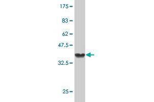 Western Blot detection against Immunogen (37 KDa) . (Stabilin 2 (STAB2) (AA 367-465) antibody)